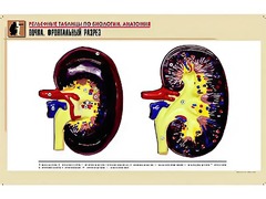 Рельефная таблица "Почка. Фронтальный разрез" (формат А1, матовое ламинирование) - fgospostavki.ru - Королёв