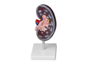 Модель почки в разрезе - fgospostavki.ru - Королёв