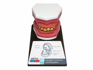 Демонстрационная модель "Ротовая полость курильщика" - fgospostavki.ru - Королёв