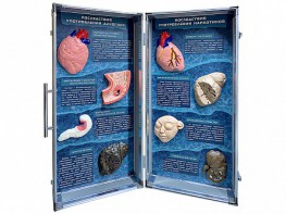 Учебно-демонстрационный кейс "Последствия употребления алкоголя и наркотиков" - fgospostavki.ru - Королёв