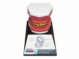 Демонстрационная модель "Ротовая полость курильщика" - fgospostavki.ru - Королёв